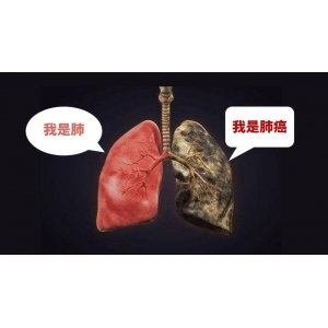 肺癌的中医病因病机
